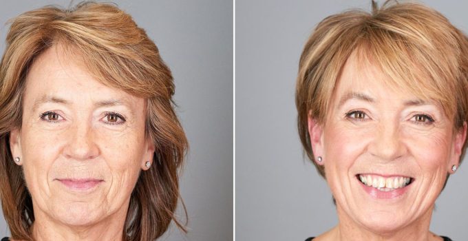 Before and After Hair Makeovers Over 50